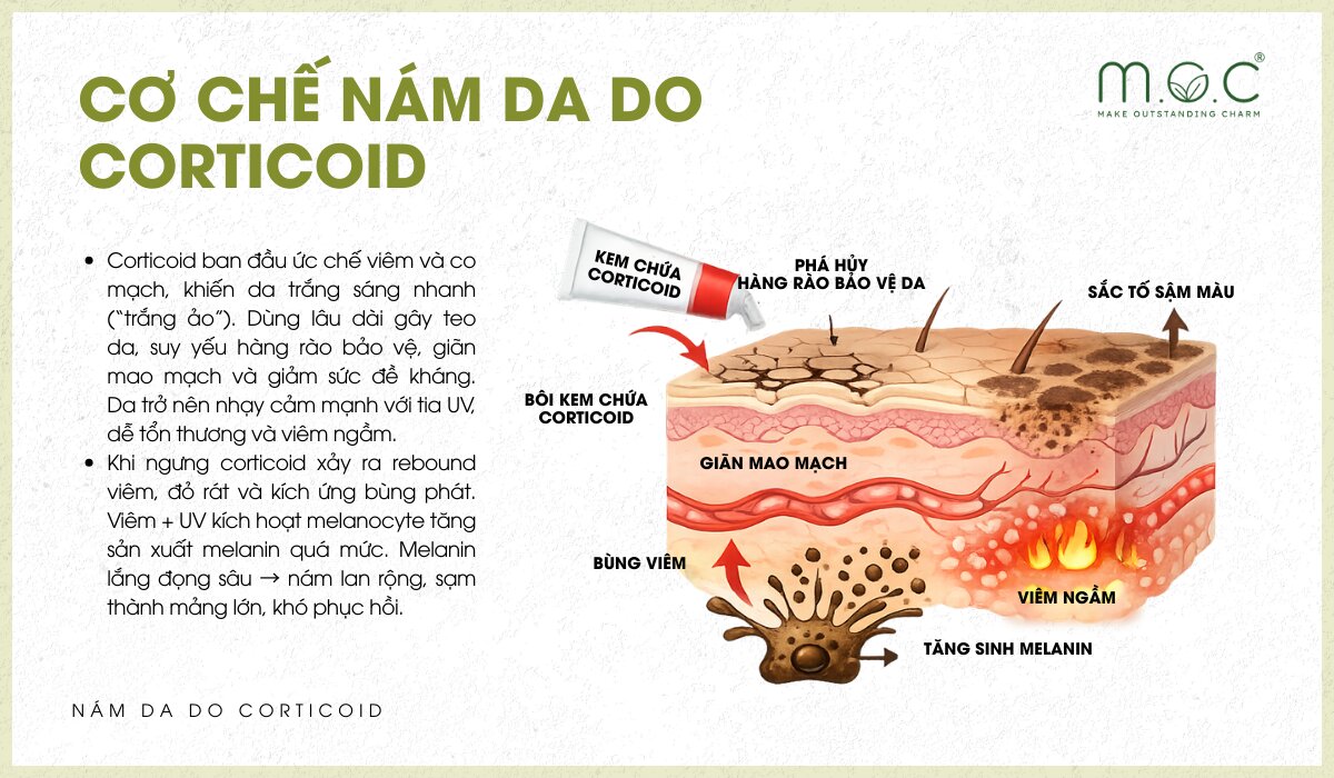 Cơ chế nám do corticoid