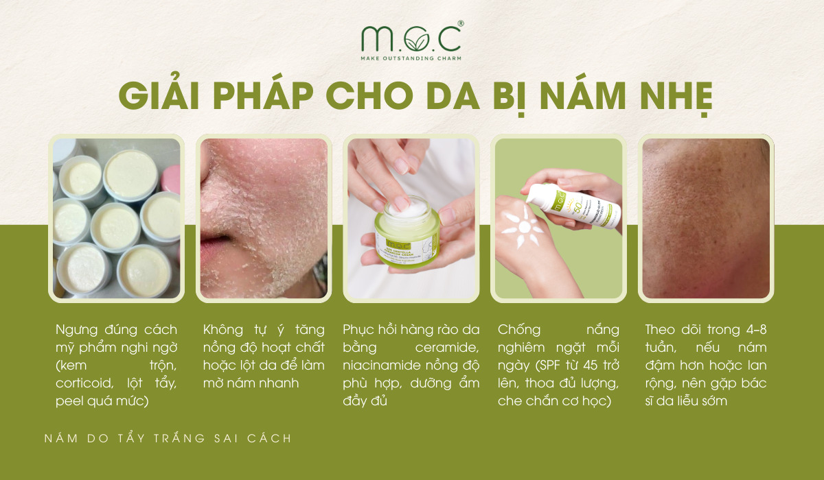 Cách cải thiện cho da nám nhẹ