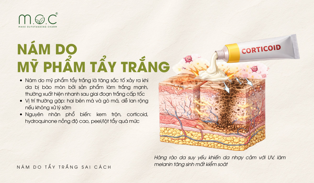 Nám do mỹ phẩm tẩy trắng là gì?