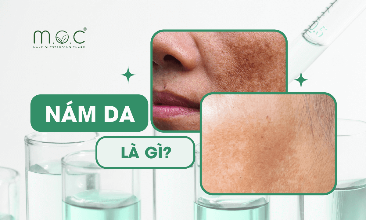 Nám da là gì?