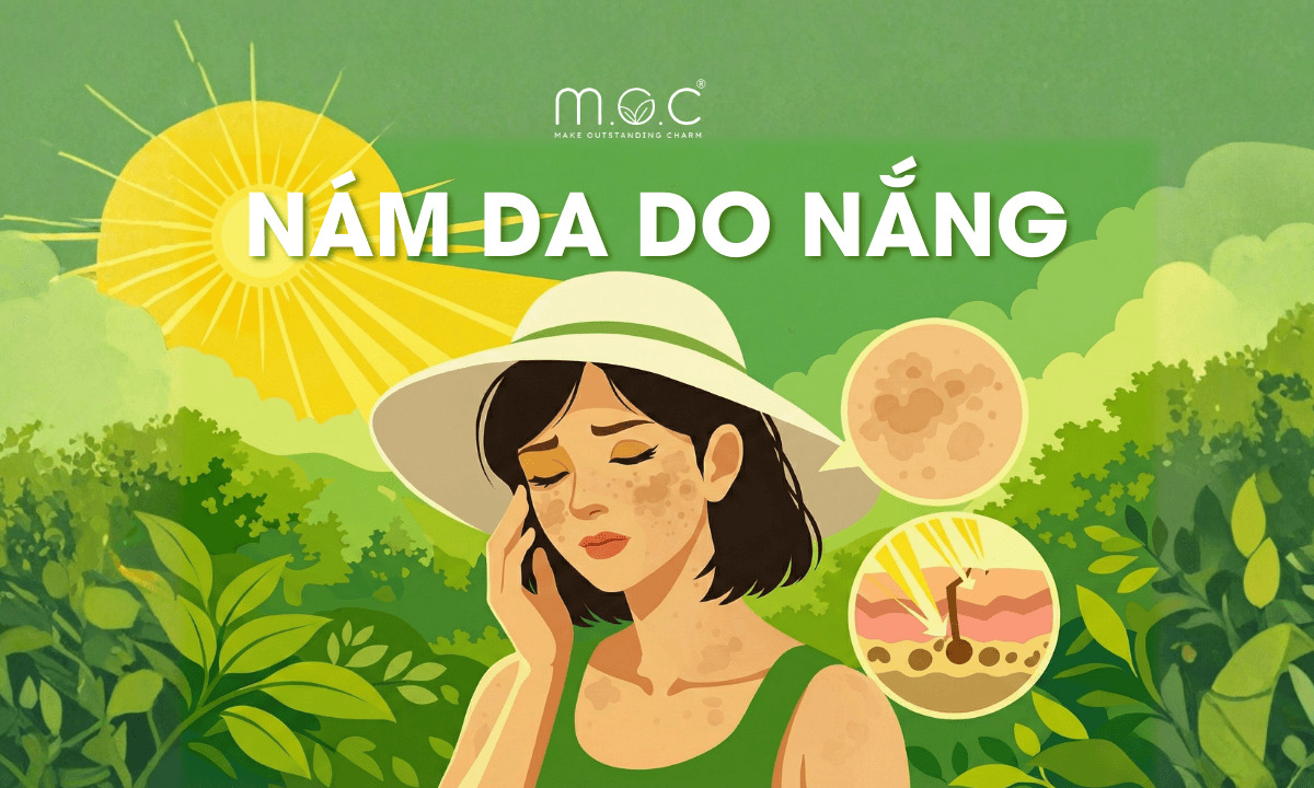 nám do nắng