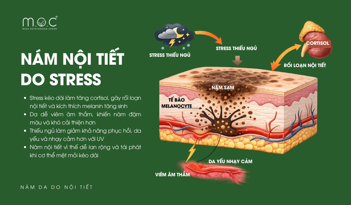 Stress kéo dài và thiếu ngủ không chỉ khiến cơ thể mệt mỏi mà còn tác động trực tiếp đến hệ nội tiết và cơ chế tạo sắc tố