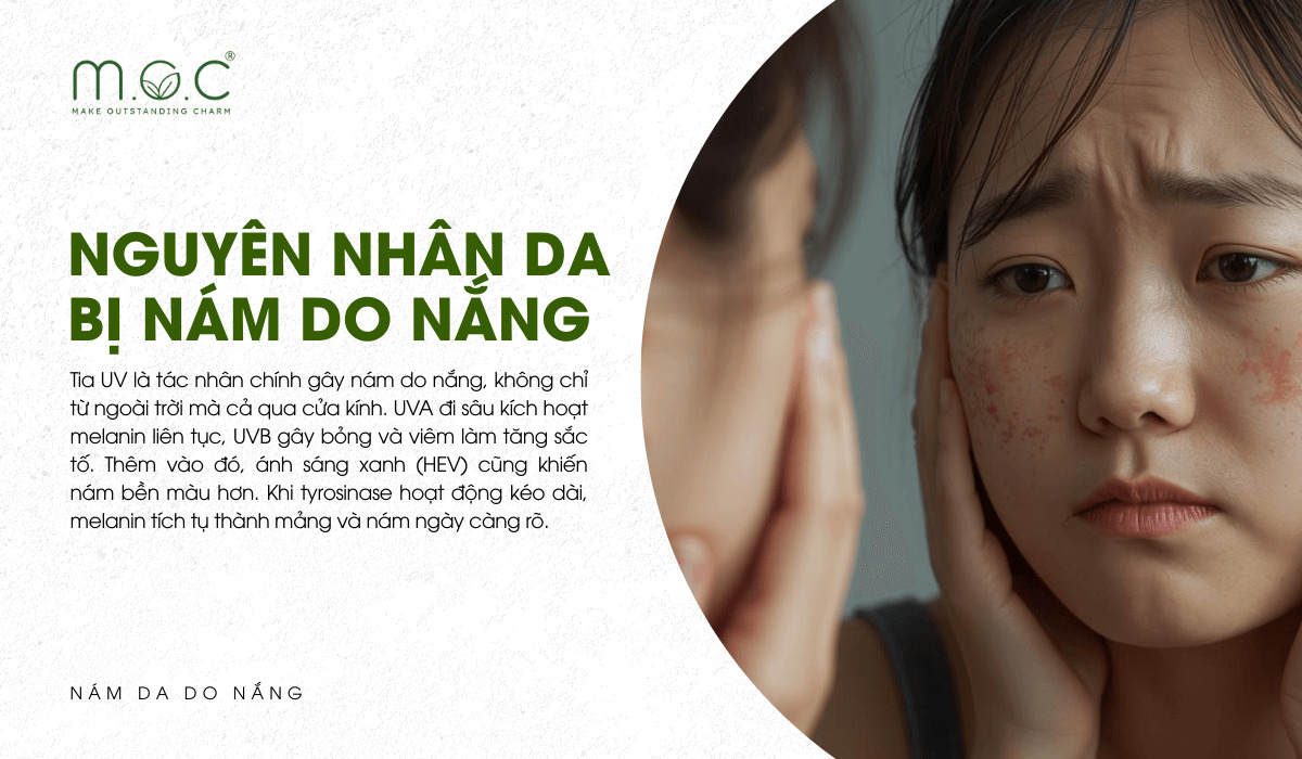 Các nguyên nhân chính nám do nắng