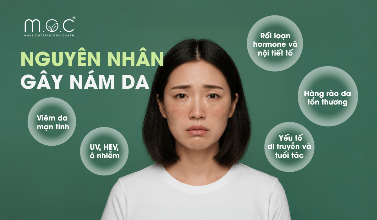 Nám da chủ yếu do tia UV, rối loạn nội tiết, viêm da và lão hóa kích thích melanin tăng sinh