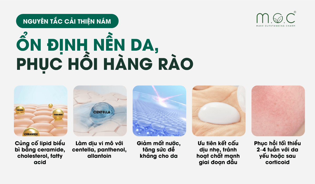 Nguyên tắc cải thiện nám da là phục hồi hàng rào bảo vệ để giảm viêm, hạn chế kích thích melanin và ngăn nám tái phát