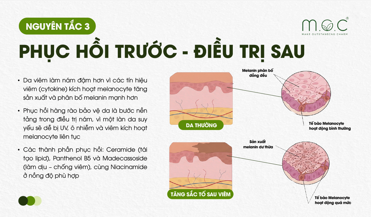 Nguyên tắc 3 cải thiện sắc tố melanin: Phục hồi trước - trị sau, duy trì liên tục