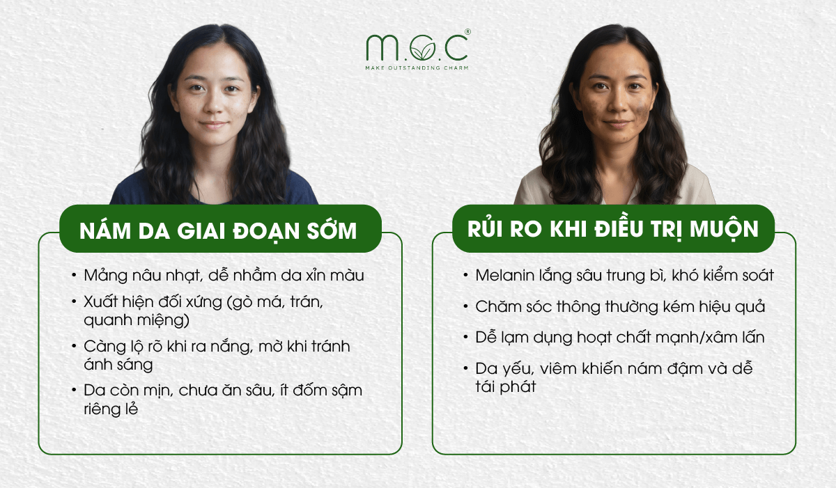 Nhận biết nám da giai đoạn sớm và muộn