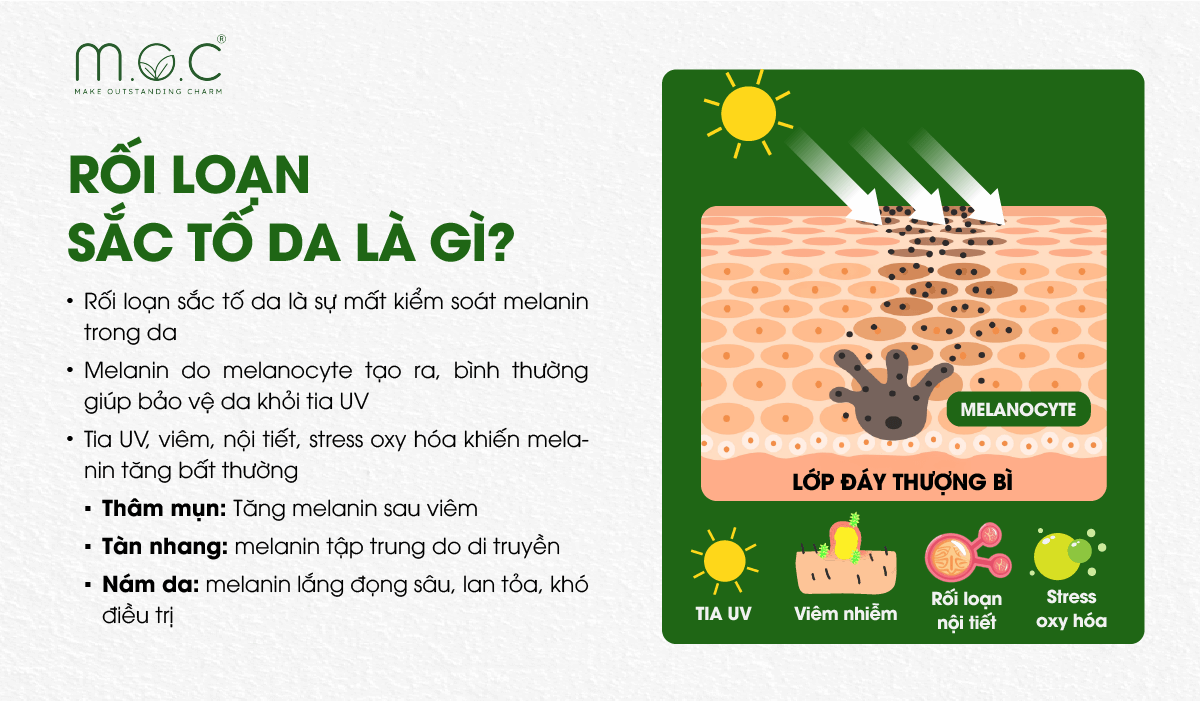 Rối loạn sắc tố da xảy ra khi quá trình tổng hợp, vận chuyển hoặc phân bố melanin trong da bị rối loạn