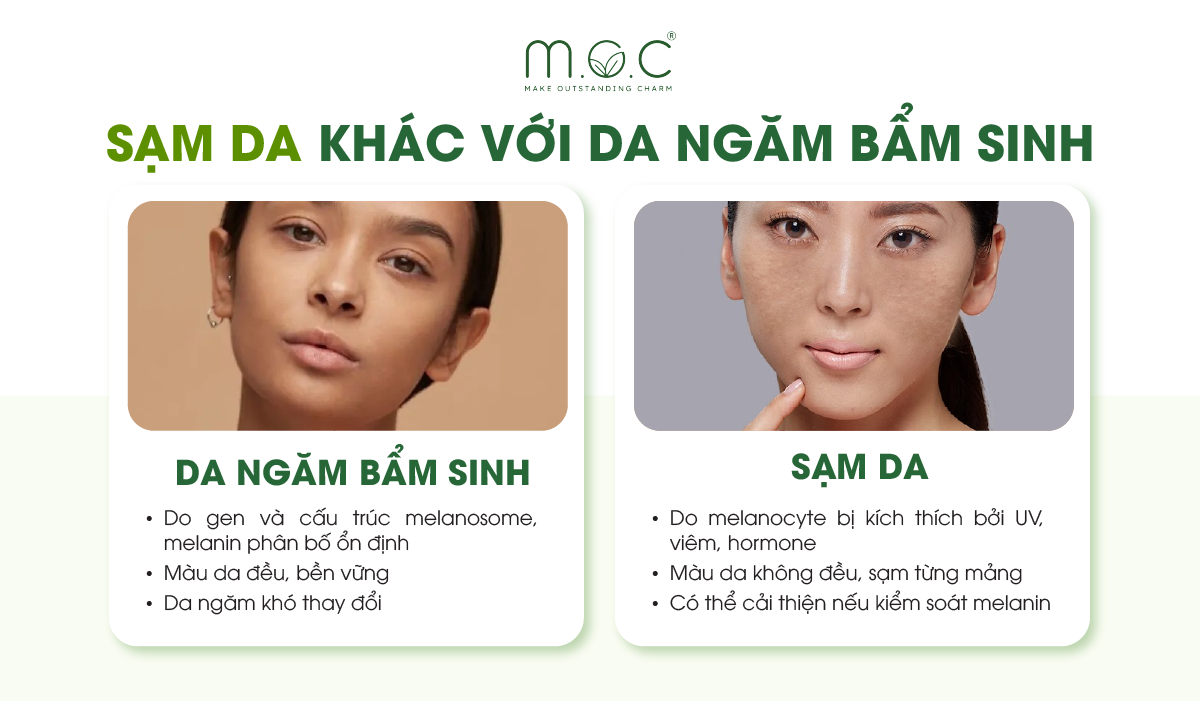 Sạm da là tình trạng tăng melanin do tác động bên ngoài như UV, viêm hay lão hóa, còn da ngăm bẩm sinh là màu da tự nhiên do di truyền quyết định