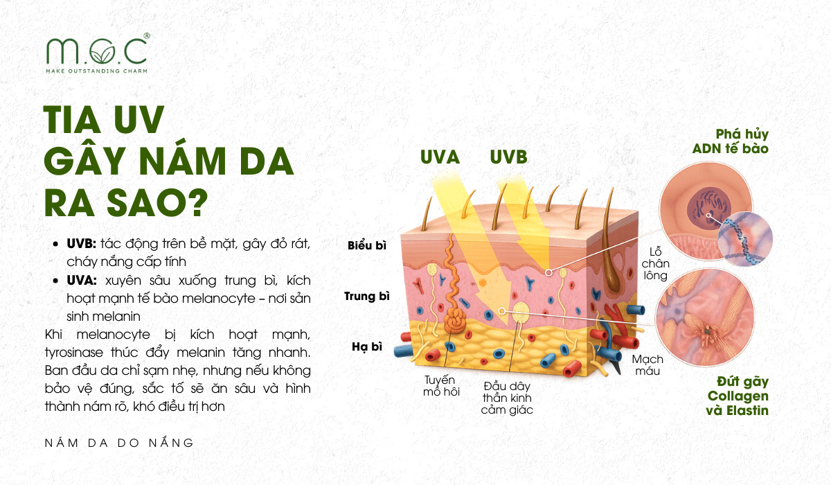 Tia UV gây nám da ra sao?