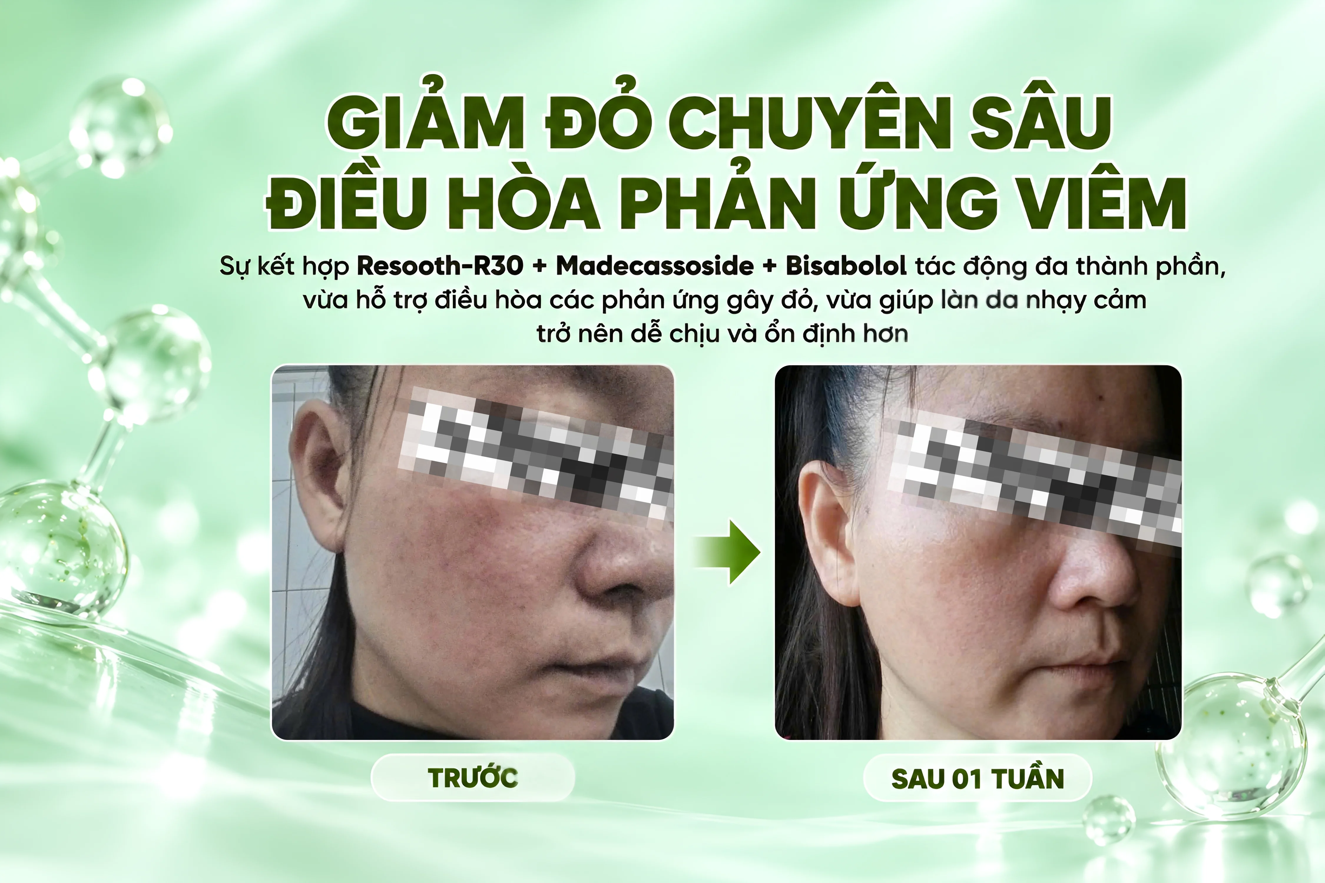 Kem-phuc-hoi-Phyto-Calm_MOC-4