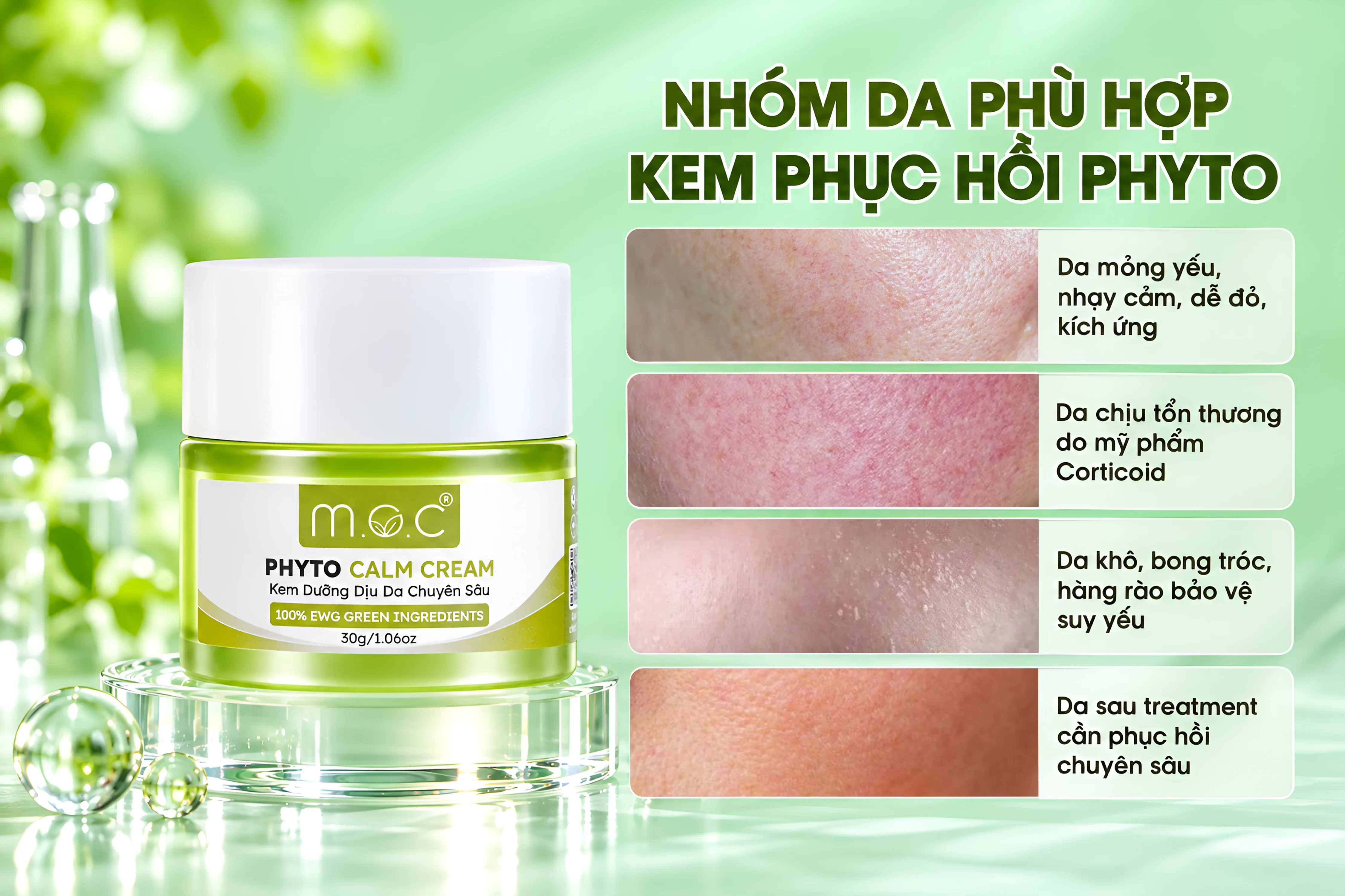Kem-phuc-hoi-Phyto-Calm_MOC-5